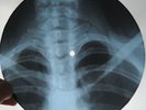 FRANK SINATRA - STRANGERS IN THE NIGHT -USSR GEORGIAN X-RAY ROENTGEN RIBS RECORD