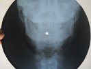 ELVIS PRESLEY - KISS ME QUICK - UNIQUE USSR GEORGIAN X-RAY ROENTGEN SKULL RECORD
