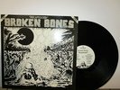BROKEN BONES 