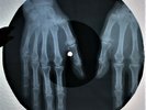 Rolling Stones - Tumbling Dice X-RAY USSR ROENTGEN Bones Record