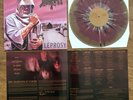 death leprosy vinyl Morbid Angel Cannibal Corpse Deicide Obituary