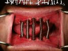 NAPALM DEATH - Coded Smears And More Uncommon Slurs [BLACK] (DLP)