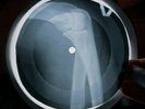 Love Alone Again Or X Ray USSR Vinyl Record Music on Bones Roentgen