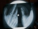 Four Tops I Can't Help Myself X Ray USSR Vinyl Record Music on Bones Roentgen