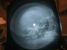 Led Zeppelin Dazed and Confused X Ray USSR Vinyl Record Music on Bones Roentgen
