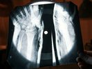 Velvet Underground White Light X Ray USSR Vinyl Record Music on Bones Roentgen