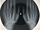 Roy Orbison - Mean Woman Blues X-RAY USSR ROENTGEN Bones Records HANDS