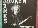 Broken Bones - 