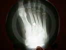 TON JONES IT'S NOT UNUSUAL X-RAY USSR VINYL RECORD MUSIC ON BONES ROENTGEN