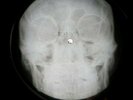 PINK FLOYD FAT OLD SUN X-RAY USSR VINYL RECORD MUSIC ON BONES ROENTGEN