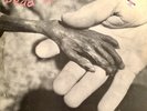 DEAD KENNEDYS Plastic Surgery Disasters 1st US PRESS 1982 Alternative Tentacles