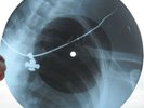 MONKEES - THE GIRL I KNEW SOMEWHERE - USSR GEORGIAN X-RAY ROENTGEN RIBS RECORD