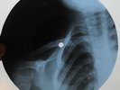 LITTLE EVA - LOCOMOTION - USSR GEORGIAN UNIQUE X-RAY BONES RECORD