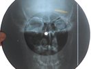 ELVIS PRESLEY - IT'S NOW OR NEVER - USSR GEORGIAN UNIQUE X-RAY SKULL RECORD