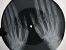 Roy Orbison - Mean Woman Blues X-RAY OF THE USSR BONE X-RAY RECORDING 8.8