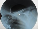 BEATLES -BABY IT'S YOU USSR GEORGIAN UNIQUE X-RAY ROENTGEN RIBS AND CROSS RECORD