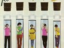 X-Ray Spex: Germfree Adolescents (Clear X-Ray Vinyl Edition) LP