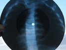 NINA SIMONE - AIN'T GOT NO, I GOT LIFE - USSR GEORGIAN UNIQUE X-RAY BONES RECORD