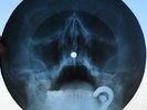 JANIS JOPLIN - COO COO -UNIQUE USSR GEORGIAN X-RAY ROENTGEN SKULL RECORD
