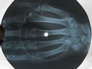 THE DOORS - PEOPLE ARE STRANGE - USSR GEORGIAN X-RAY ROENTGEN HAND BONES RECORD