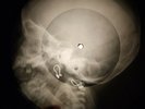 Beatles - Michelle X-RAY BONE OF THE USSR X-RAY RECORDING