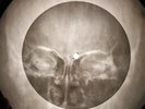 Shadows - Man of Mystery X-RAY BONE OF THE USSR X-RAY RECORDING