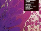 Pink Floyd - 1965 Their First Recordings - 2 x 7