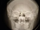 Velvet Underground - Femme Fatale X-RAY BONE OF THE USSR RECORDING SKULL