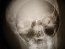 T.Rex - Children of The Revolution X-RAY OF THE USSR X-RAY BONE RECORDING