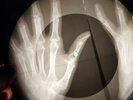 Elvis Presley - Blue Suede Shoes X-RAY OF THE USSR X-RAY RECORDING BONE