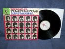 The Beatles ?– A Hard Day's Night           Odeon ?– SMO 83739
