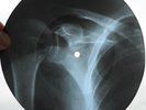 THE MONKEES -THE GIRL I KNEW SOMEWHERE-USSR GEORGIAN X-RAY ROENTGEN BONES RECORD