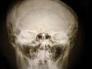 Doors - The Crystal Ship X-RAY USSR BONE RECORDING SKULL X-RAY
