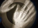 James Brown - Papa's Got A Brand New Bag X-RAY USSR X-RAY BONE RECORDING