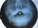 EDDIE COCHRAN - JEANNIE JEANNIE... - USSR GEORGIAN X-RAY ROENTGEN SKULL RECORD