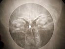 Frank Sinatra - Strangers In The Night X-RAY OF THE USSR X-RAY BONE RECORDING