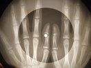 Beatles - Love Me Do X-RAY OF THE USSR X-RAY BONE RECORDING