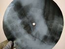 DAVID BOWIE MEMORY OF FREE FEST XRay USSR Record Roentgen Bones Ribs Music Vinyl