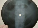 BEATLES YOU WONT SEE ME X-Ray USSR Record Roentgen Bones Ribs Music Vinyl