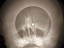 Louis Prima - Pennies From Heaven X-RAY OF THE USSR X-RAY BONES RECORDING