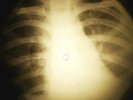 Doors - Love Her Madly X-RAY OF THE USSR X-RAY BONE RECORDING