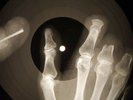 Johnny Cash - Folsom Prison Blues X-RAY OF USSR X-RAY BONES RECORD