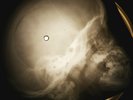 Bob Dylan - Subterranean Homesick Blues X-RAY OF USSR X-RAY BONE RECORDING