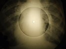 Doors - Changeling X-RAY OF USSR X-RAY BONES RECORDING