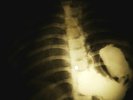 Kinks - Waterloo Sunset  X-RAY OF USSR X-RAY BONE RECORD