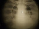 Doors - Not To Touch The Earth X-RAY OF THE USSR X-RAY BONES RECORDING