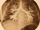 Kinks - A Well Respected Man X-RAY OF THE USSR X-RAY BONES RECORD