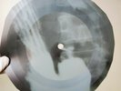 PINK FLOYD FAT OLD SUN X-Ray USSR Record Roentgen Bones Music Vinyl
