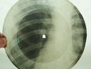 X-RAY 78rpm MARINO MARINI - Oho Aha USSR AUDIO ROENTGEN BONES Ribs Thorax 1960s