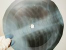 NINA SIMONE I RUT A SPELL  X-Ray USSR Record Roentgen Bones Ribs Music Vinyl
